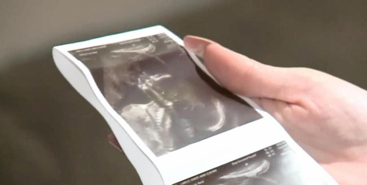 ecografia volto padre