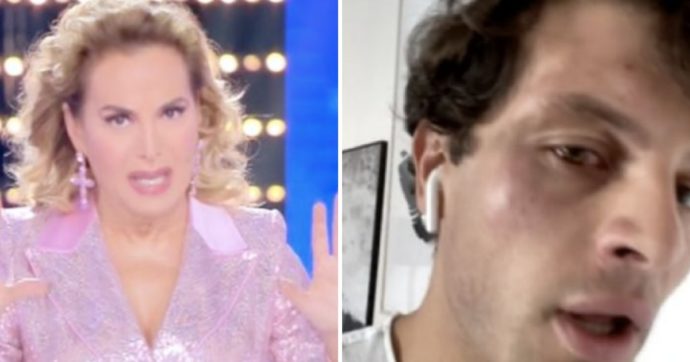 Iconize, finta aggressione omofoba? "Si è colpito da solo con un surgelato..."