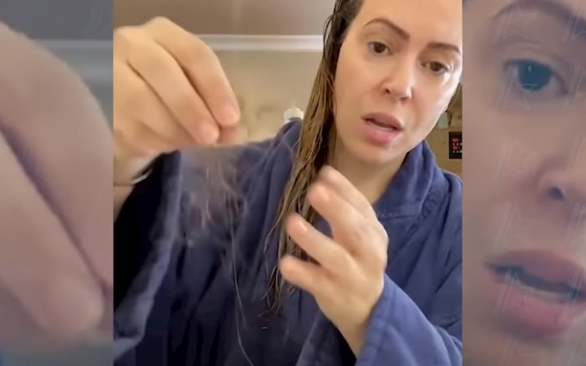 Coronavirus caduta dei capelli: uno su tre li perde a 3 mesi dalla guarigione