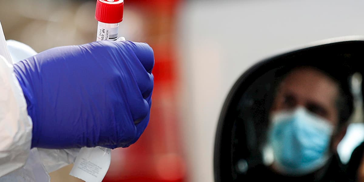 nuovo sintomo coronavirus caduta denti