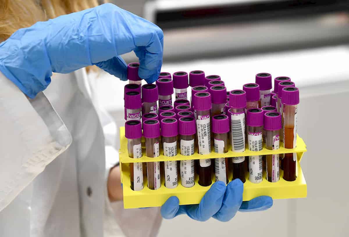 covid anticorpi virus protetto