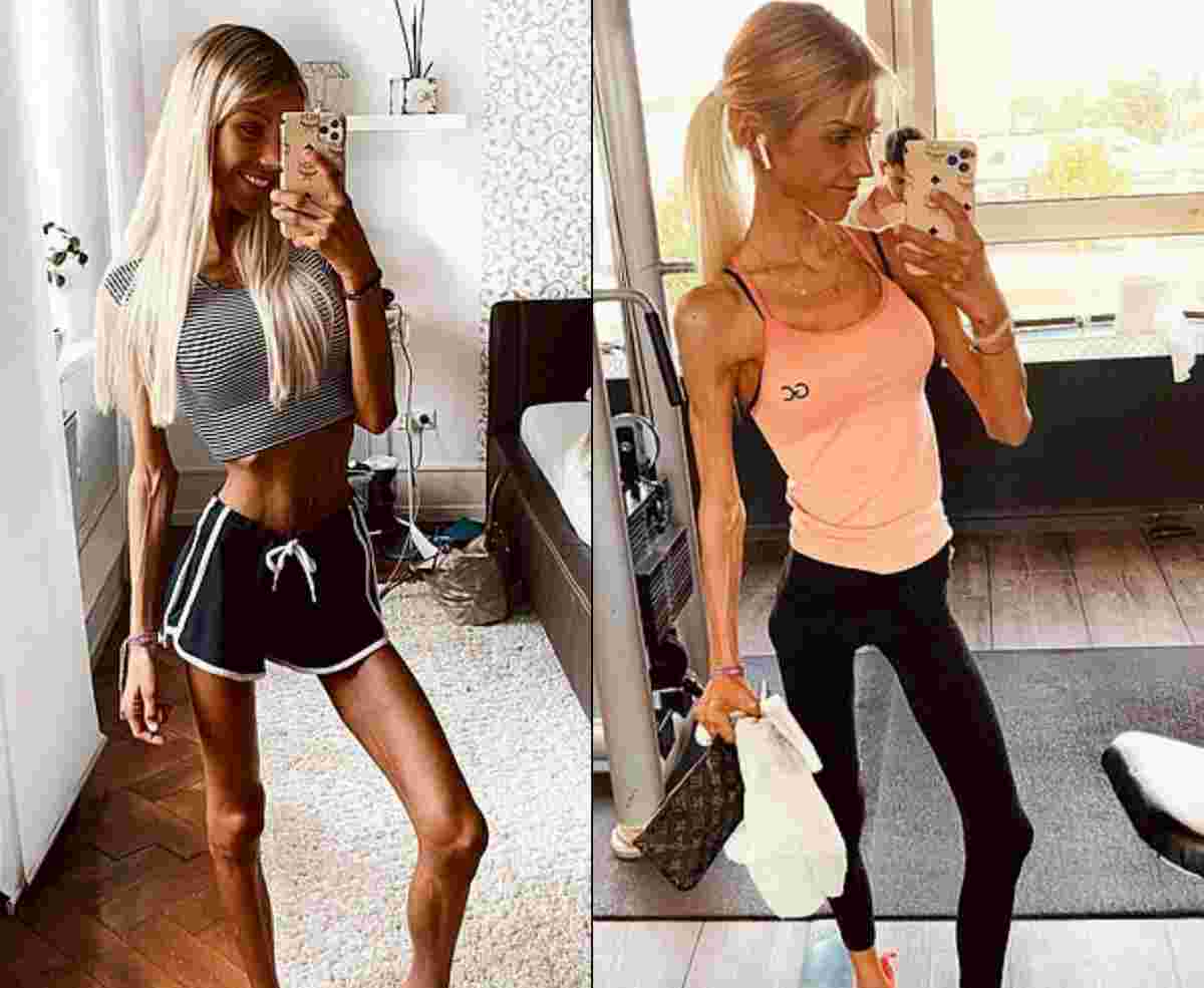 Josi Maria, influencer tedesca morta a 24 anni di anoressia: raccontava sui social la sua lotta