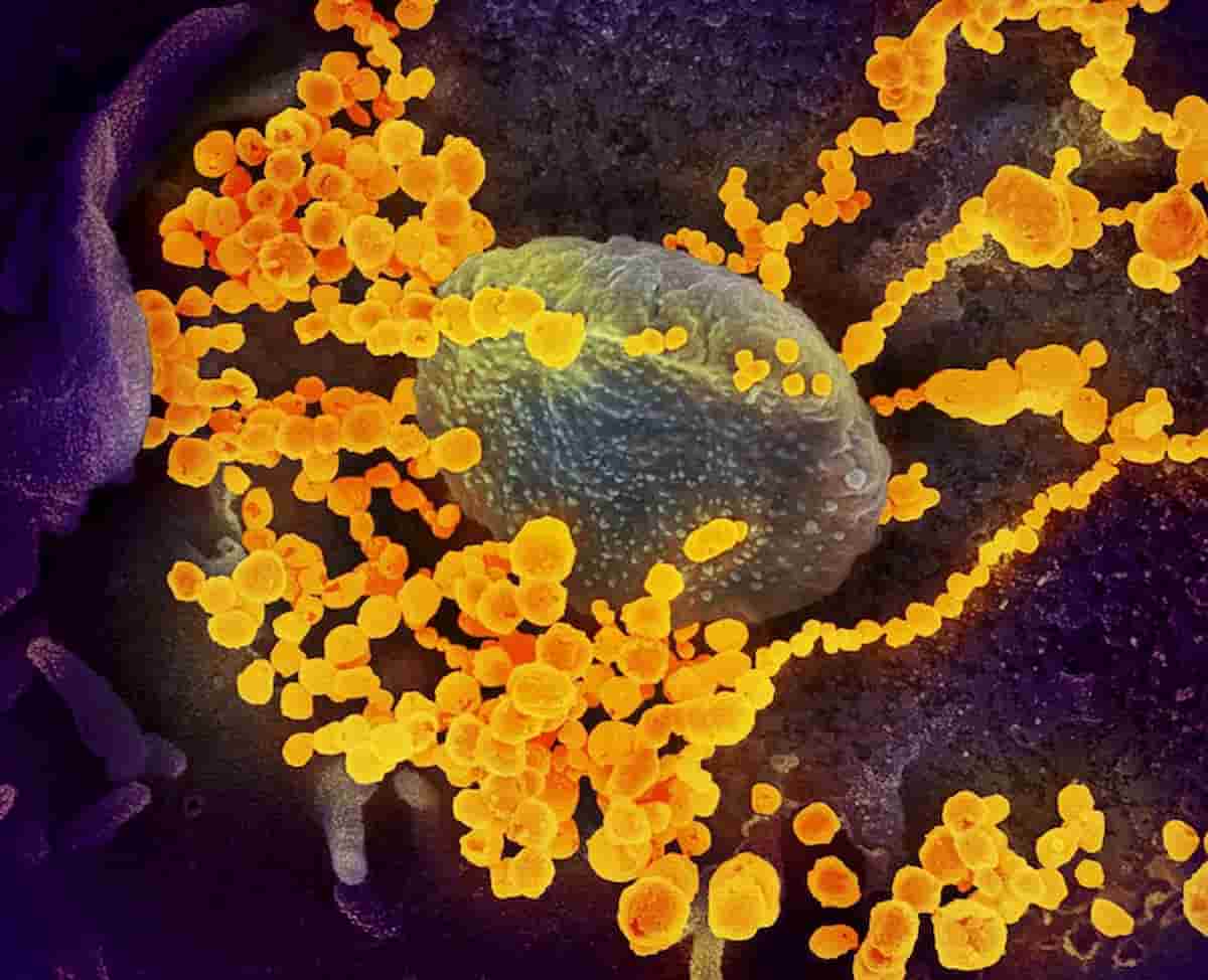 Coronavirus nuova variante California