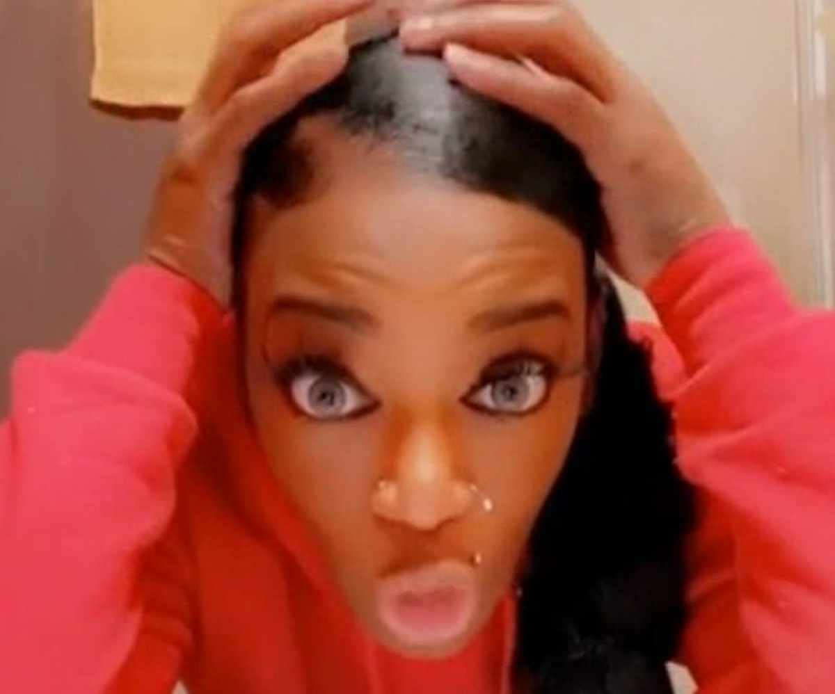 Mamma usa colla spray come lacca per capelli: 4 ore dal chirurgo plastico per rimuoverla