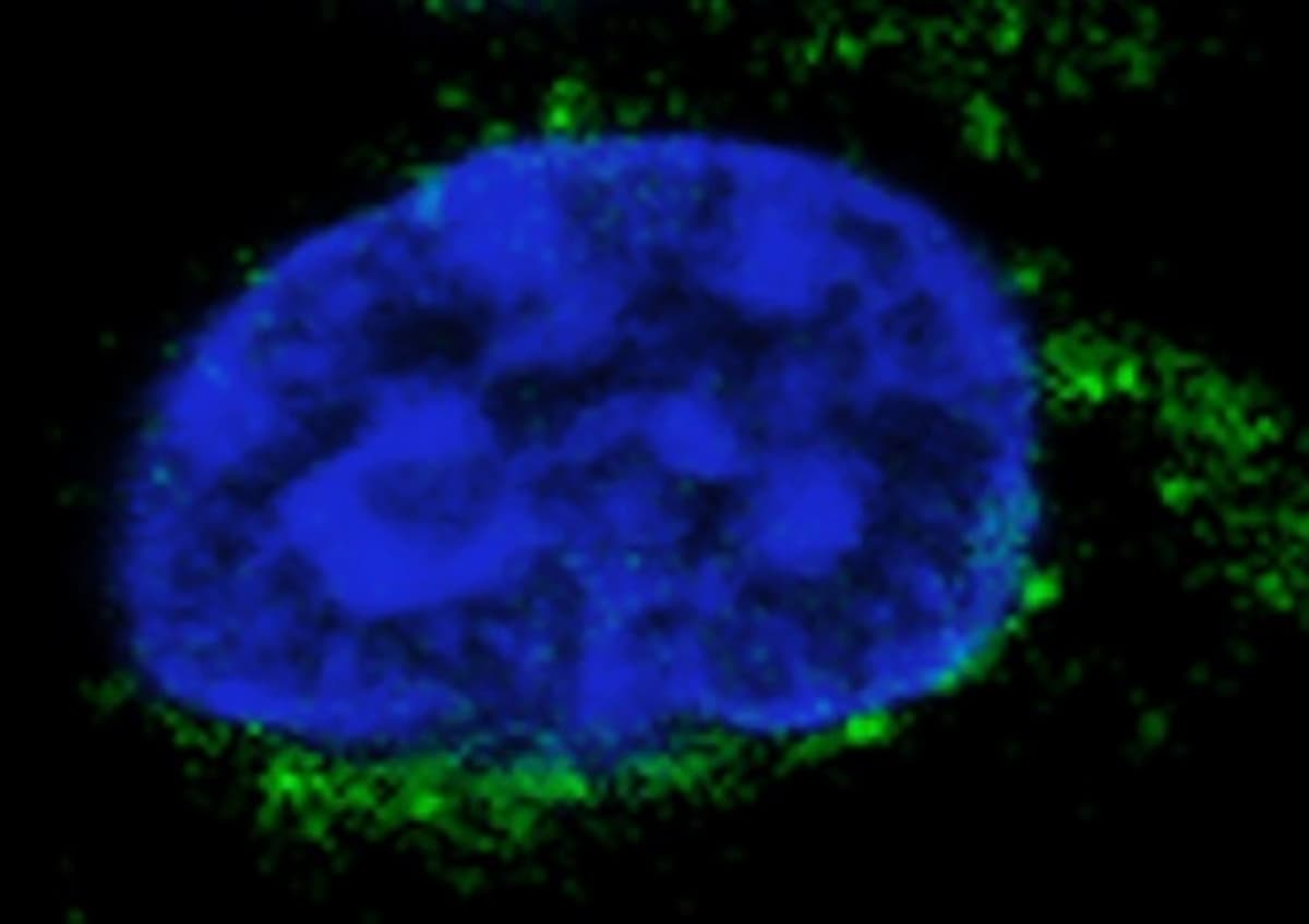 Covid, nuove cellule staminali super efficienti contro i virus: la scorciatoia del sistema immunitario