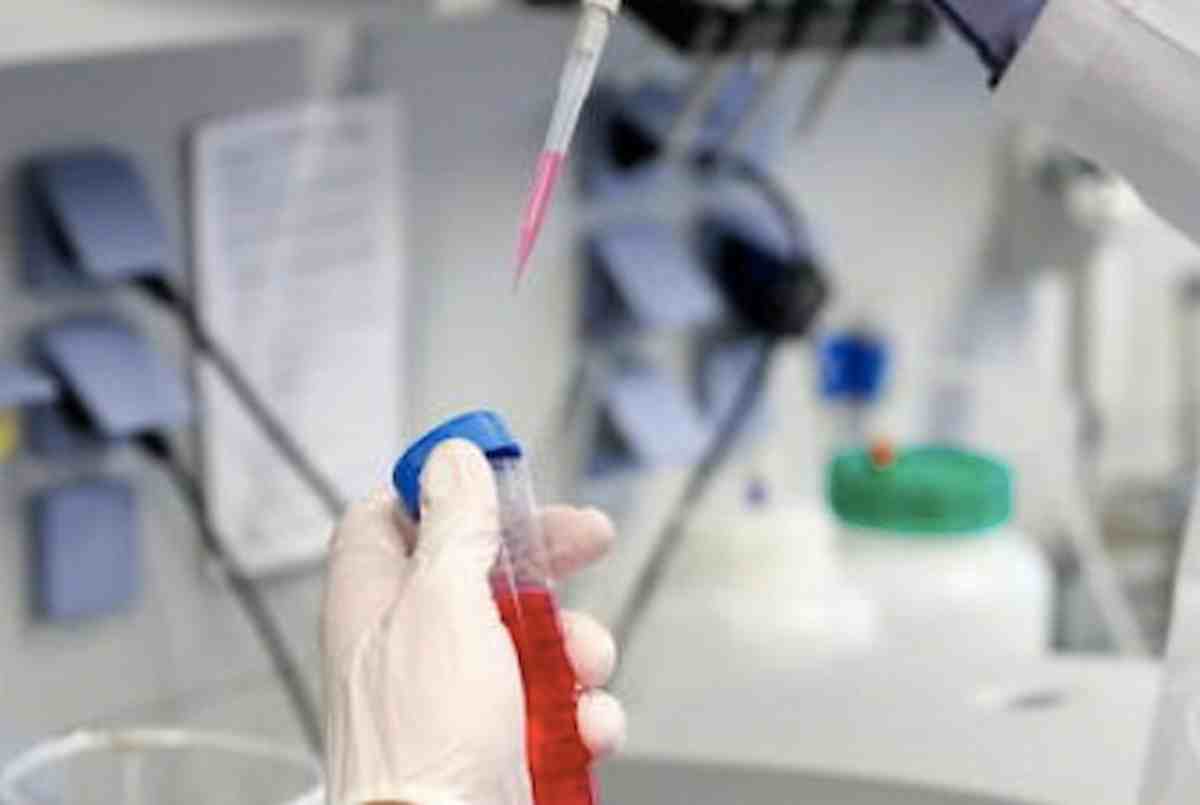 Coronavirus, il bollettino del 29 marzo 2021: 12.916 nuovi positivi, 417 morti, tasso positività all'8,2%