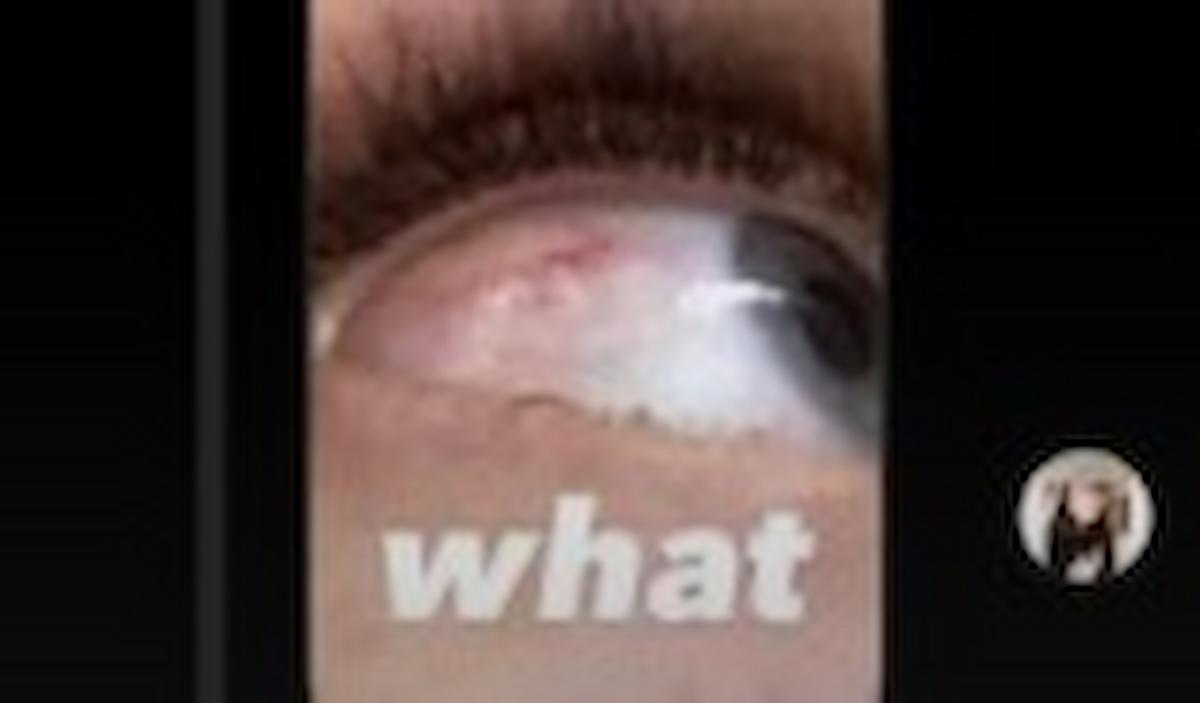 Jasmine Carrisi lancia l'allarme su Instagram: โMi sono rotta lโocchio. Aiutoโ, ecco cosa รจ successo in realtร ...