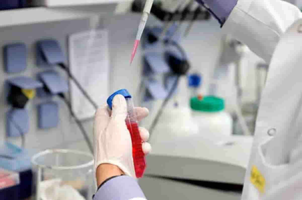 Coronavirus, lo studio tedesco su 26 autopsie: "E' il Covid che uccide e non le malattie preesistenti"