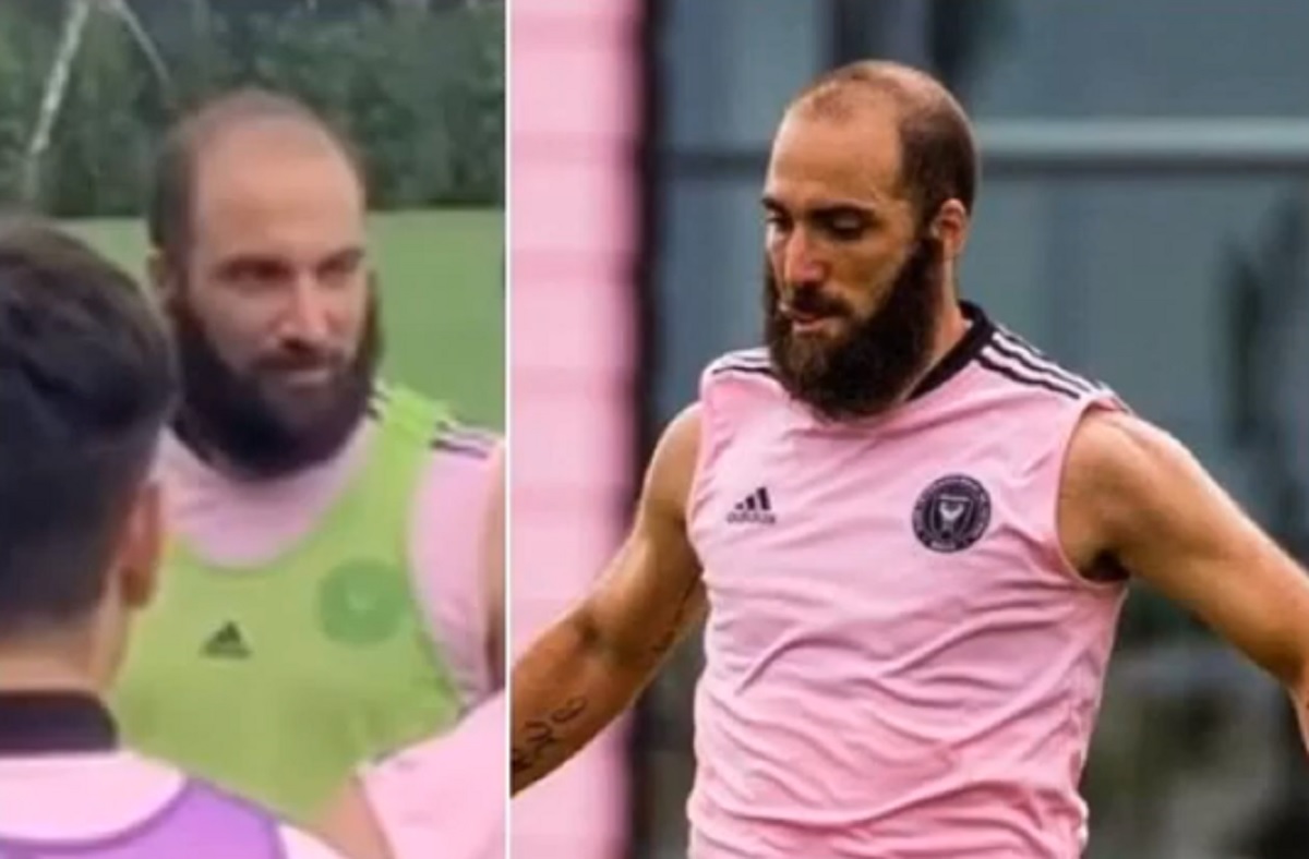 Higuain lunga barba rossa e zero capelli, sul web lo paragonano a Giobbe Covatta