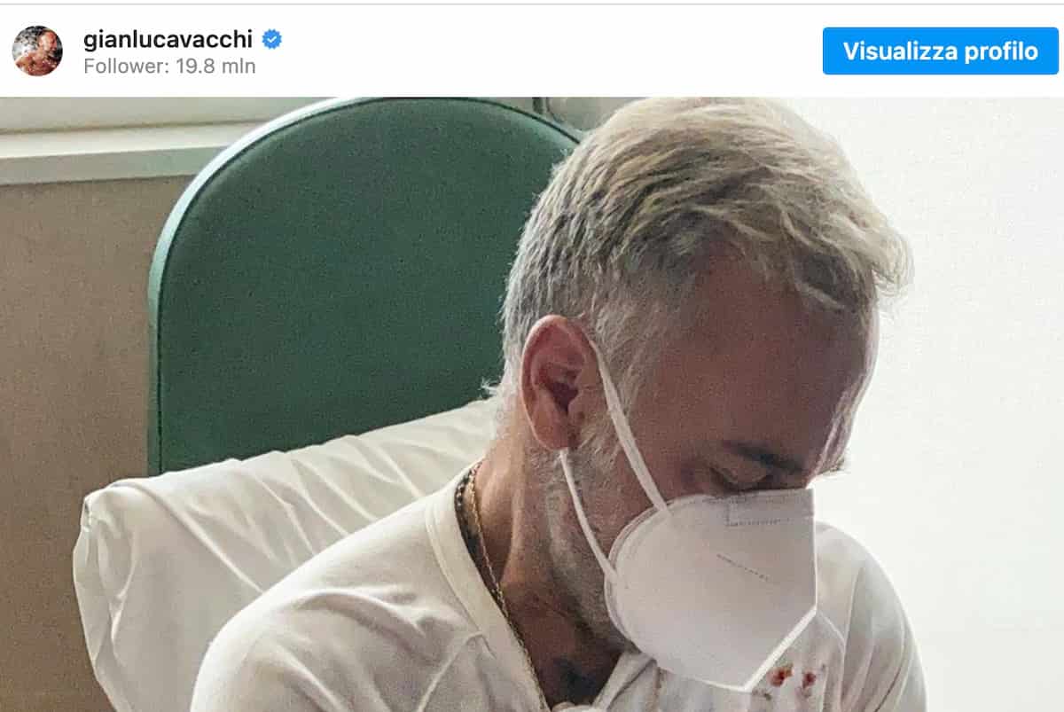 La figlia di Gianluca Vacchi operata per palatoschisi congenita. Ecco cos'è questa malattia