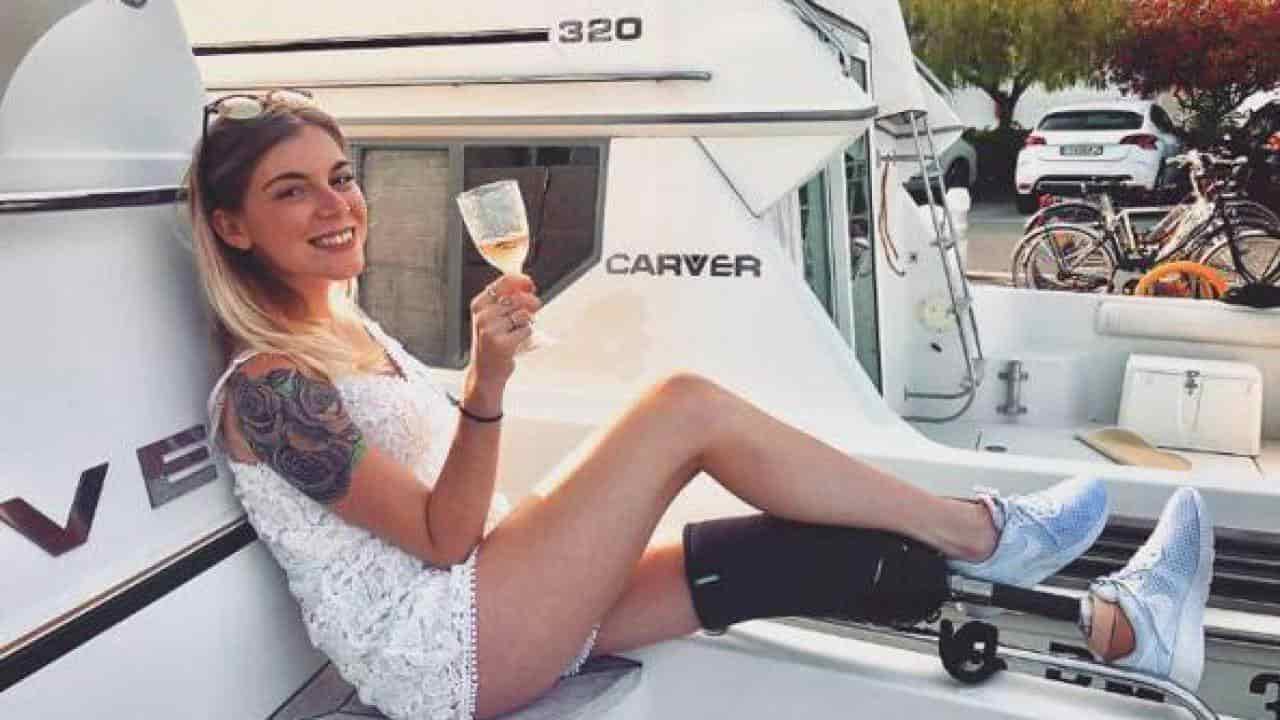 Nina Rima, chi è, età, fidanzato, incidente e vita privata della modella che ha perso una gamba