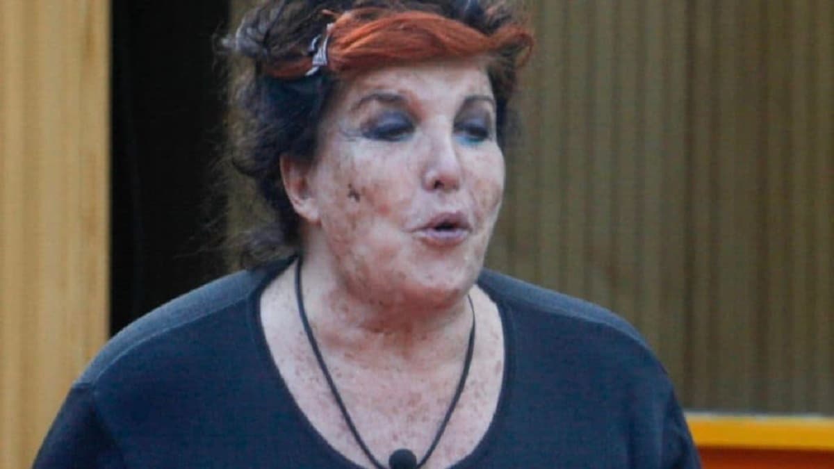 Patrizia De Blanck e la malattia che le ha sfigurato il volto: "Ho riscihato di morire"