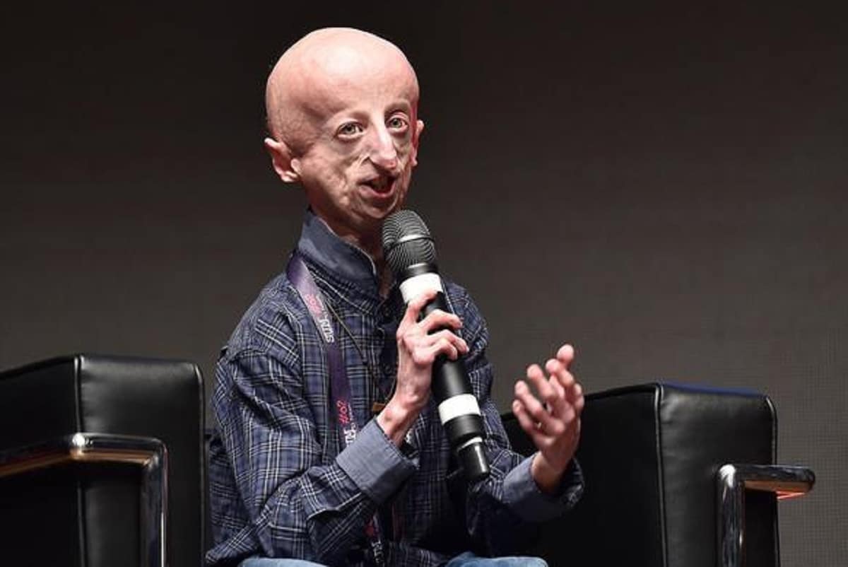 Sammy Basso chi è, malattia, progeria, quanti anni ha, mamma, fidanzata, famiglia, biografia