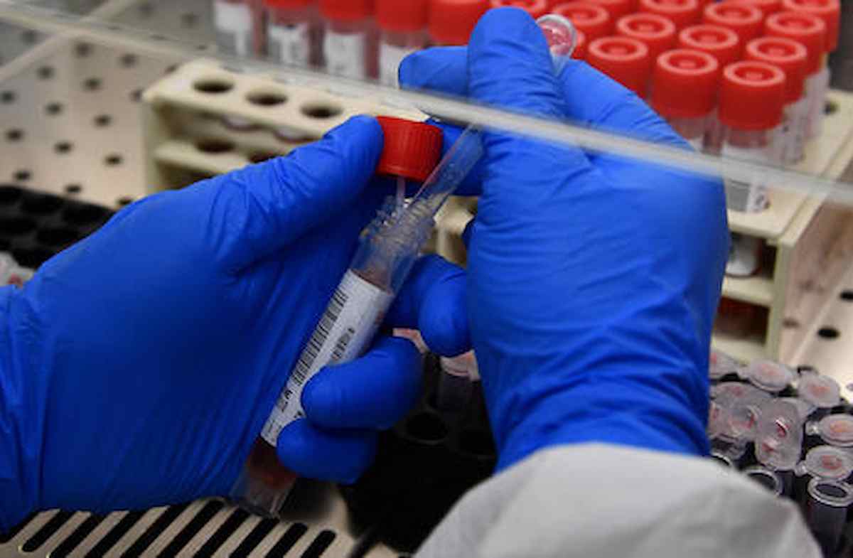 coronavirus, foto ansa