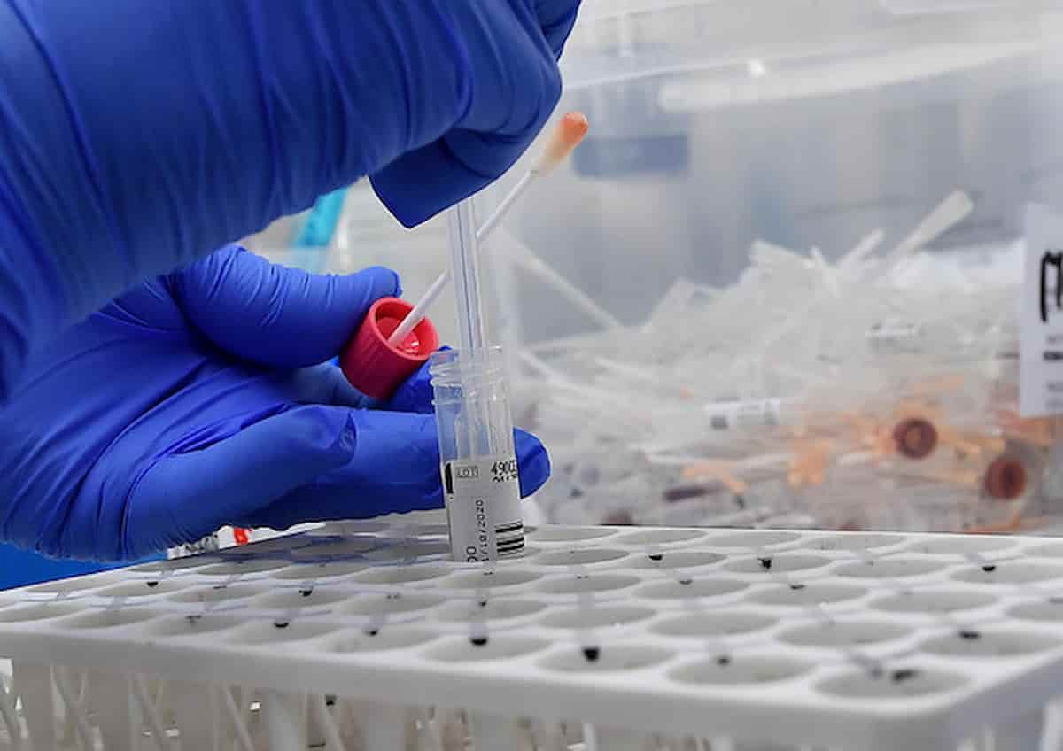 Coronavirus bollettino 12 luglio