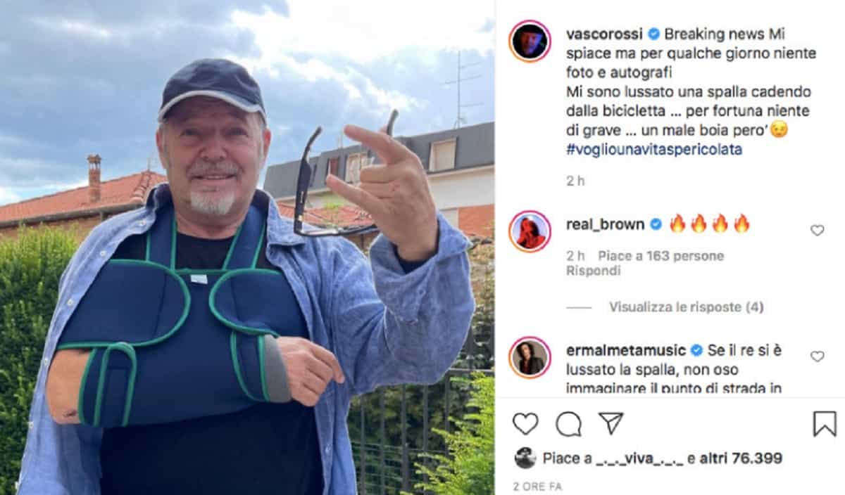 Vasco Rossi incidente in bicicletta, il cantante si è lussato una spalla: la FOTO sui social