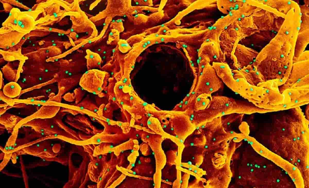 Pandemia toglie un anno di vita (4 a Bergamo): aspettativa vita uomini 79 anni, donne 84