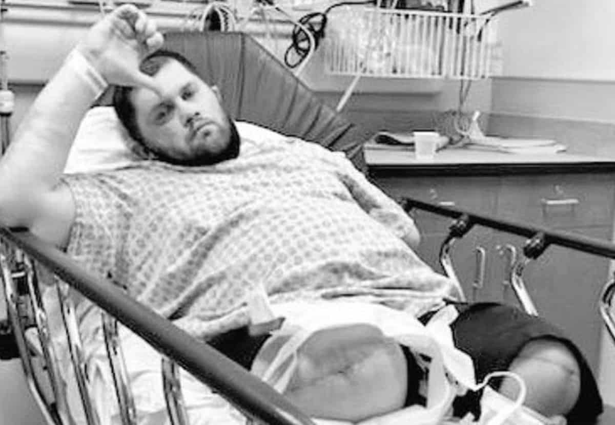 Jimmy Rave, il dramma dell'ex wrestler: gambe amputata a causa di una infezione