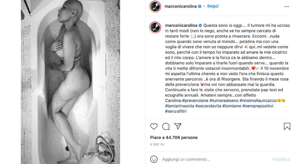 Carolina Marconi nuda su Instagram: "Il tumore mi ha ucciso in tanti modi, ma sono pronta a rinascere"