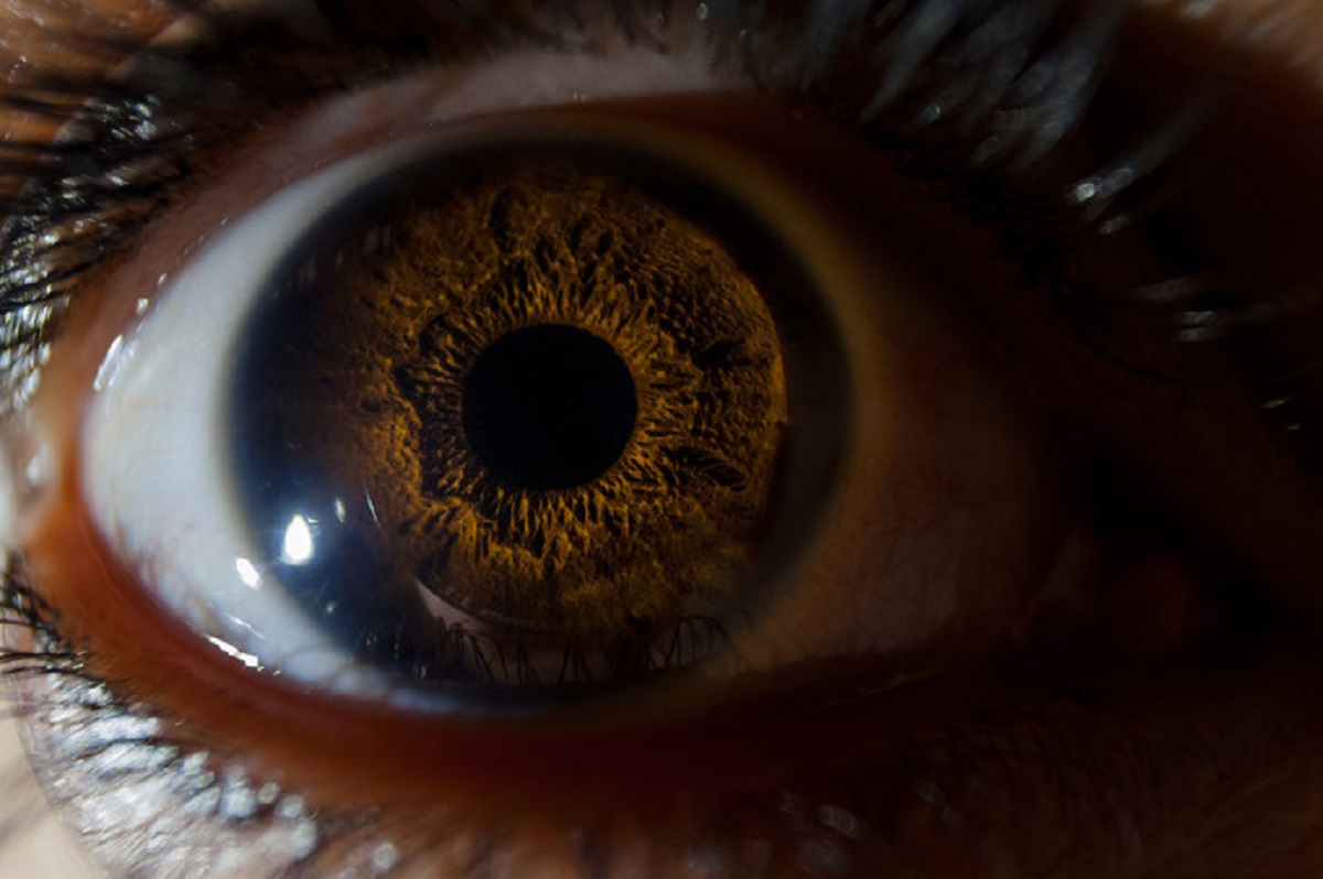 Iraniano condannato all'accecamento dopo aver fatto perdere un occhio al vicino