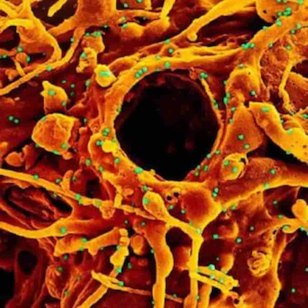Covid, finirà l'incubo? Grazie a vaccini e mascherine si muore meno di un anno fa, coronavirus come raffreddore?