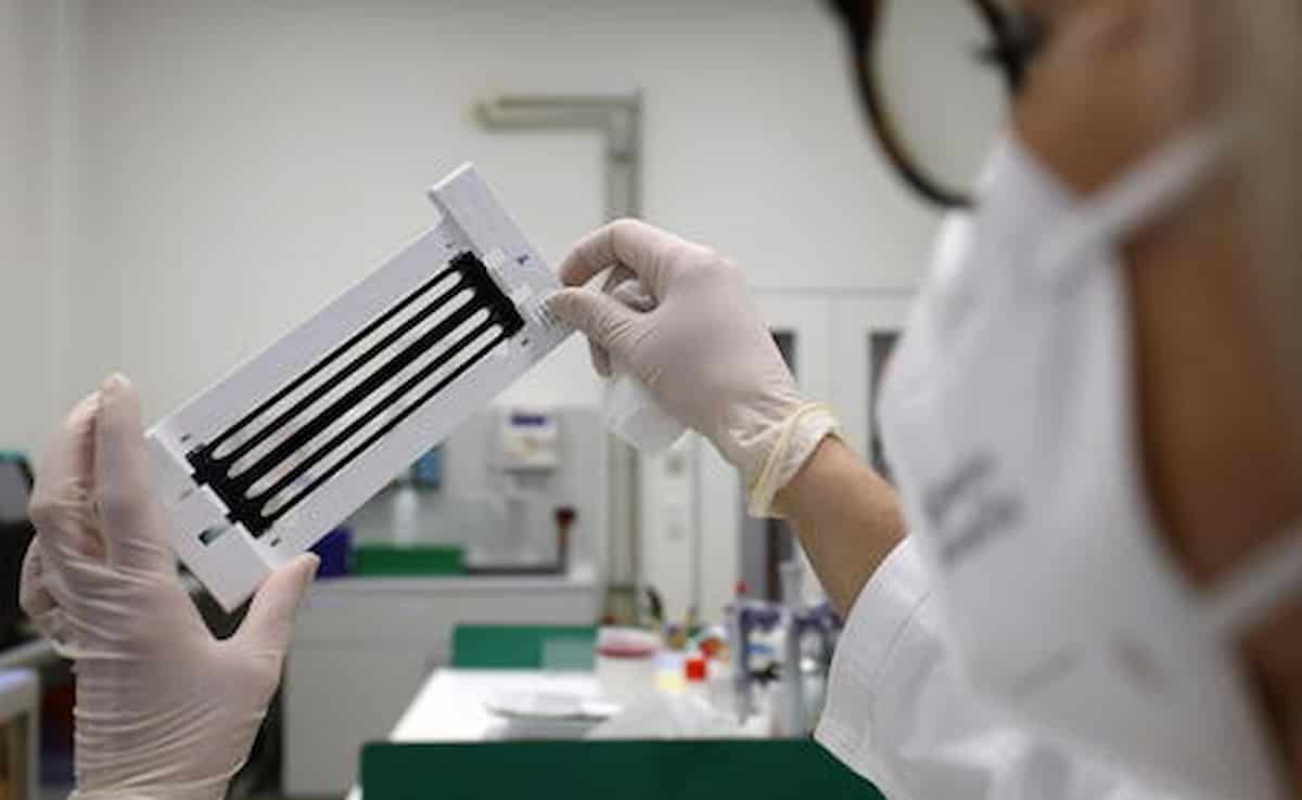 Vaiolo delle scimmie sesso