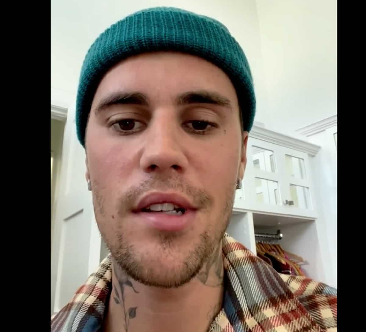 Justin Bieber, paralisi a metà viso: "Ho la sindrome di Ramsay Hunt. Non posso tornare sul palco"