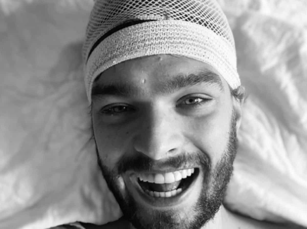 Riccardo Manera, l'annuncio dell'attore: "Ho una lesione tumorale alla testa"