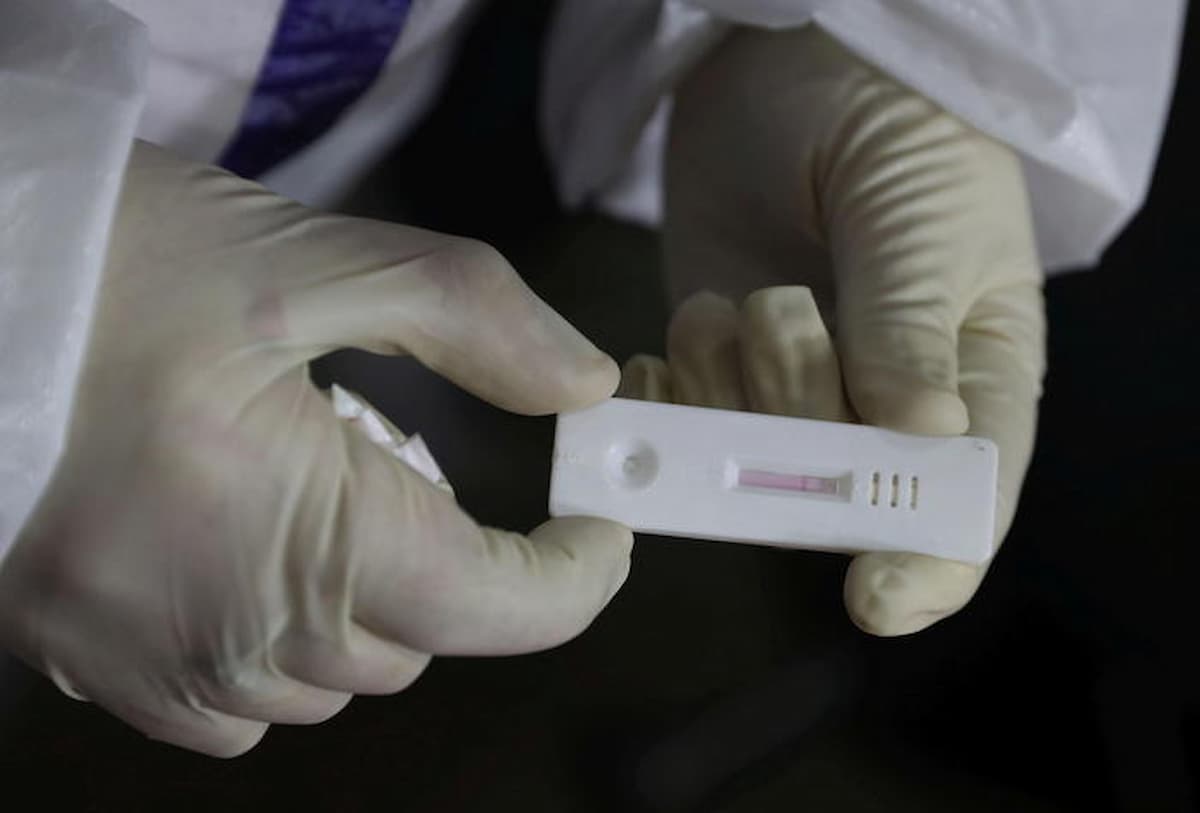 catanese positivo covid vaiolo hiv