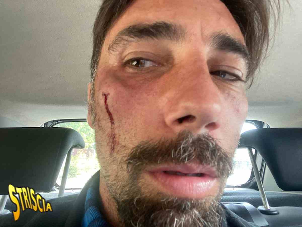 Vittorio Brumotti di Striscia picchiato e rapinato in vacanza a Los Angeles: "Mi hanno messo la pistola in bocca"