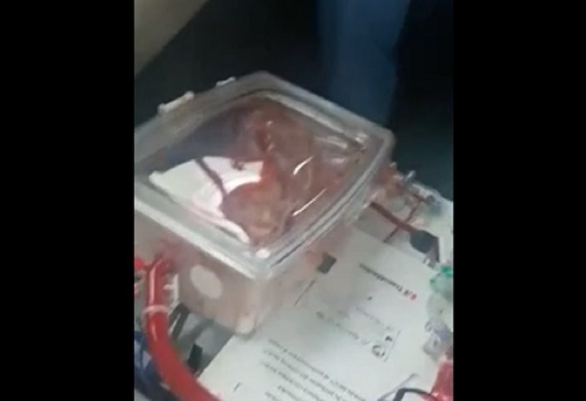 "Cuore in scatola" tenuto in vita, continua a battere: il primo trapianto in Italia VIDEO