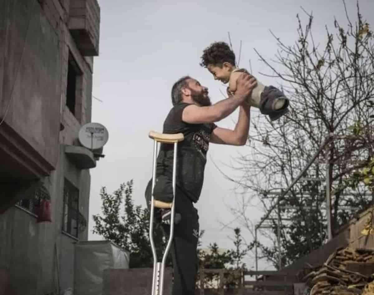 Mustafa, da Budrio riparte la speranza per il bimbo nato senza arti: e papà Munzir riavrà la gamba