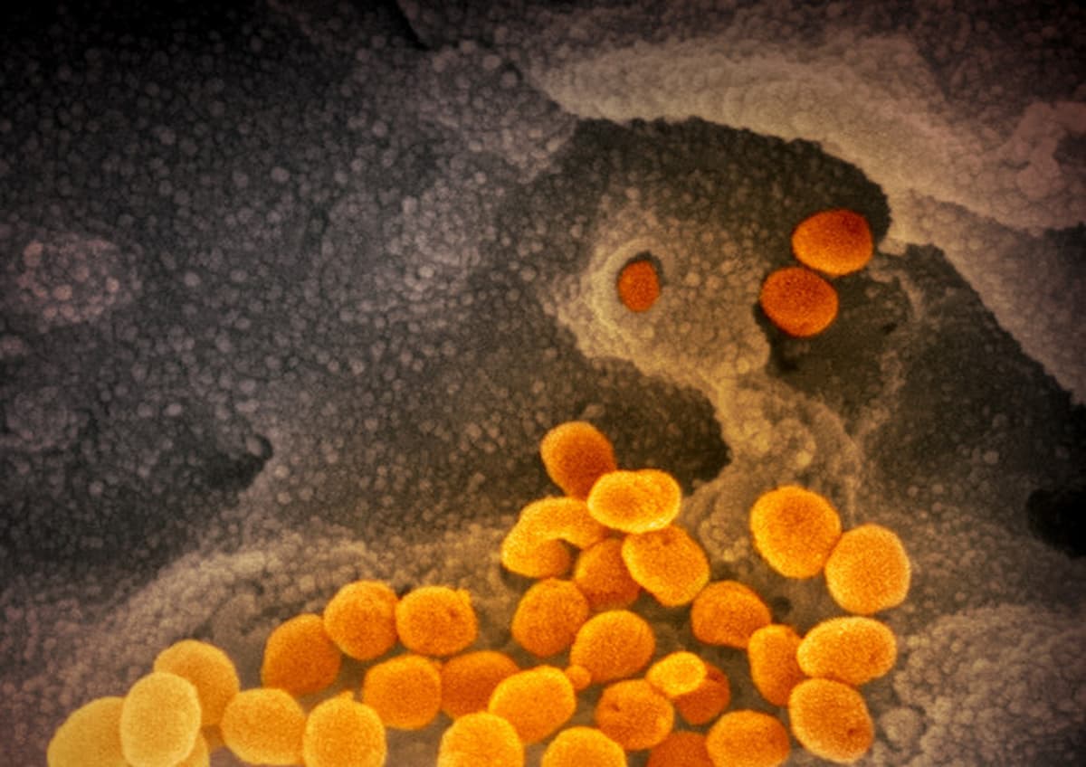 Il Covid “non esiste più”? virus indebolito, ma l'inverno è in agguato, il virus è meno violento, le cure efficaci ma le varianti si moltiplicano