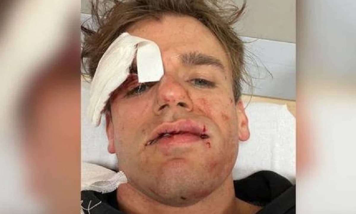 Jacopo Malnati, il comico de iPantellas picchiato e rapinato a Varese: "Mi hanno puntato una pistola alla tempia"