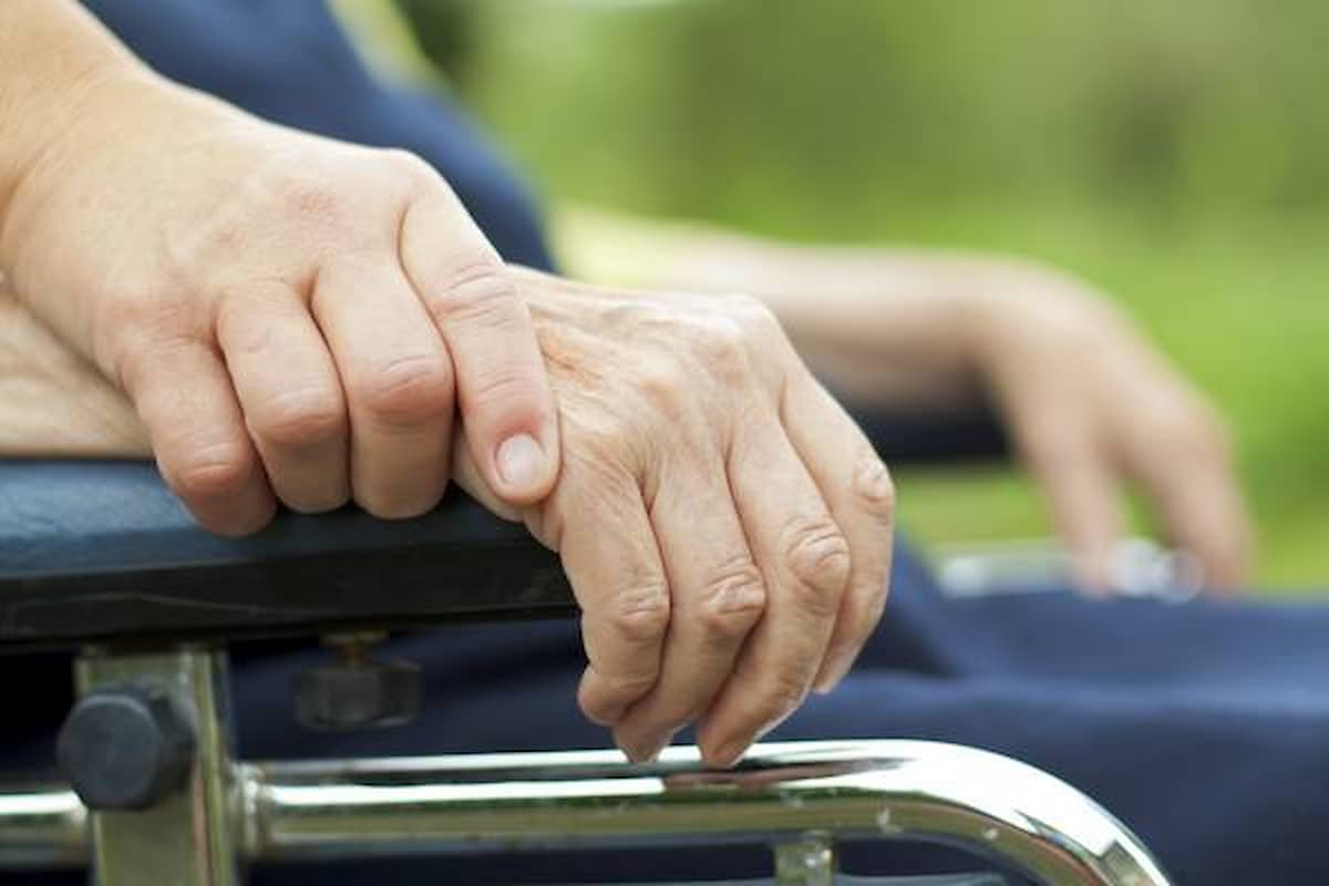 demenza parkinson mesencefalo