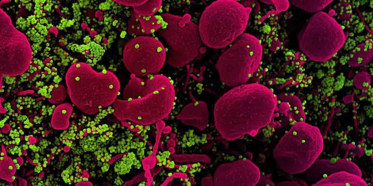 Il Covid fu insabbiato dalla Cina: nacque nel laboratorio di Wuhan, 95% di morti in meno senza il depistaggio