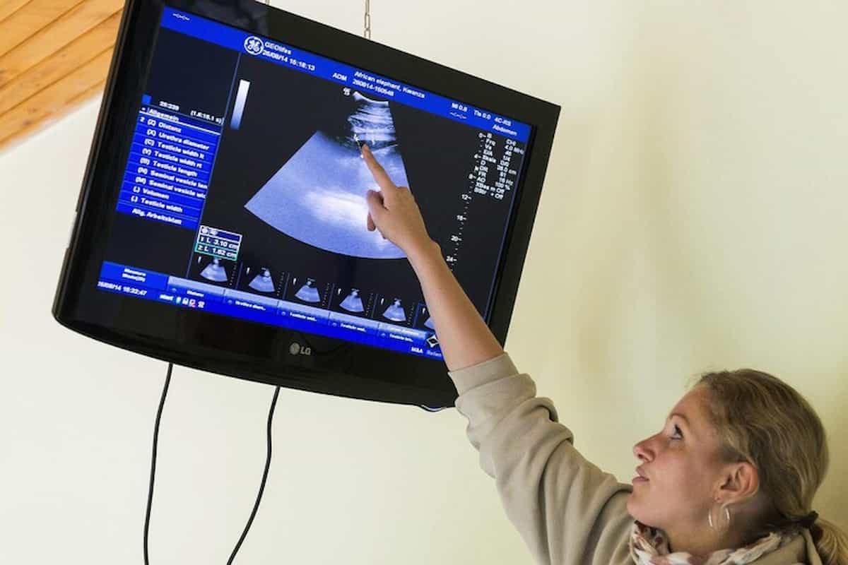 tumore endometrio terapia combinata