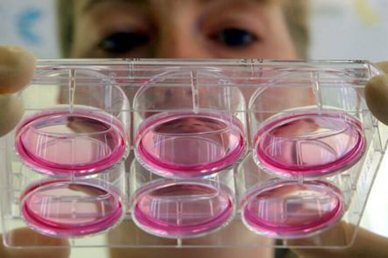 parinson aumenta con la solitudine