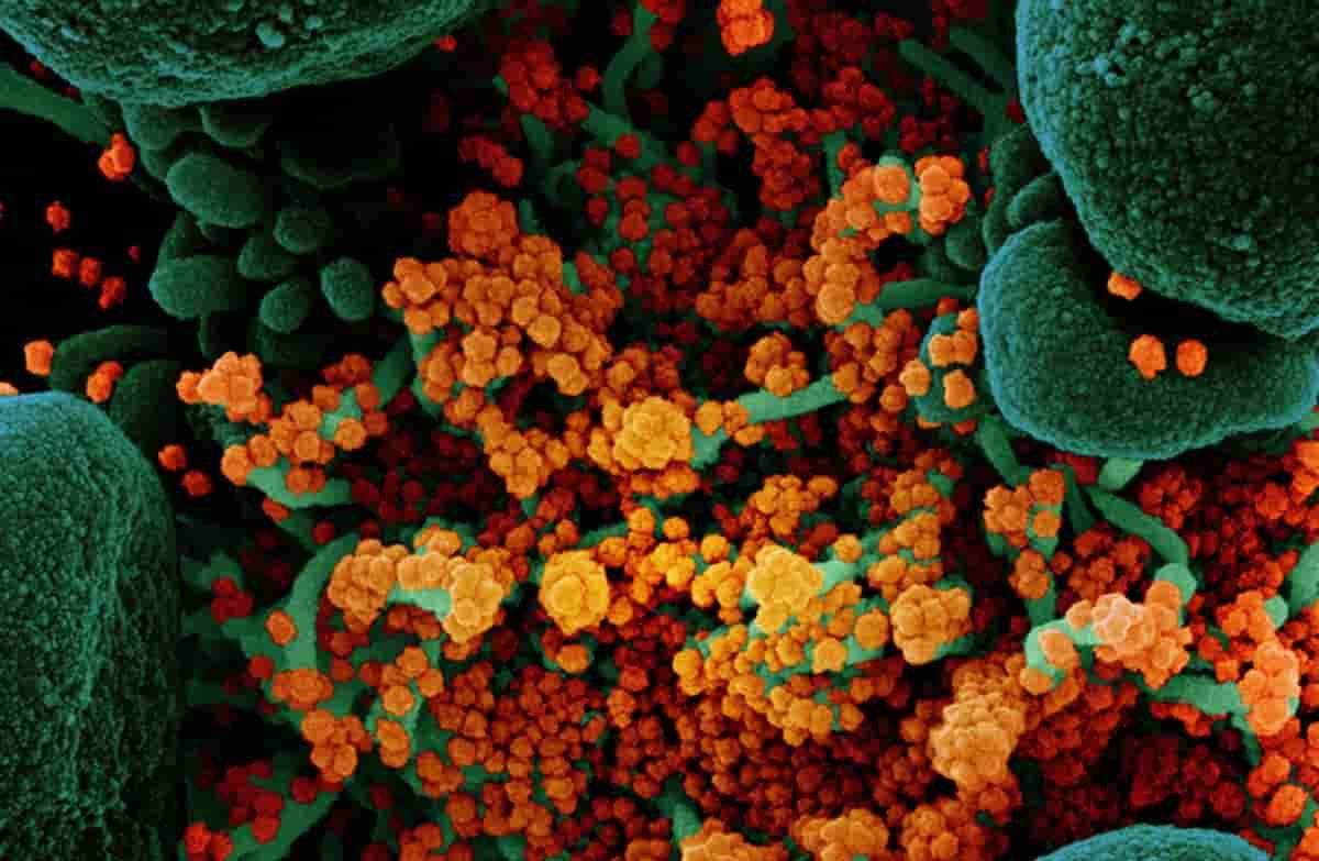 Il Virus Vampiro, lo studio dell'Università del Maryland. Ecco perché si chiama così. Foto Ansa