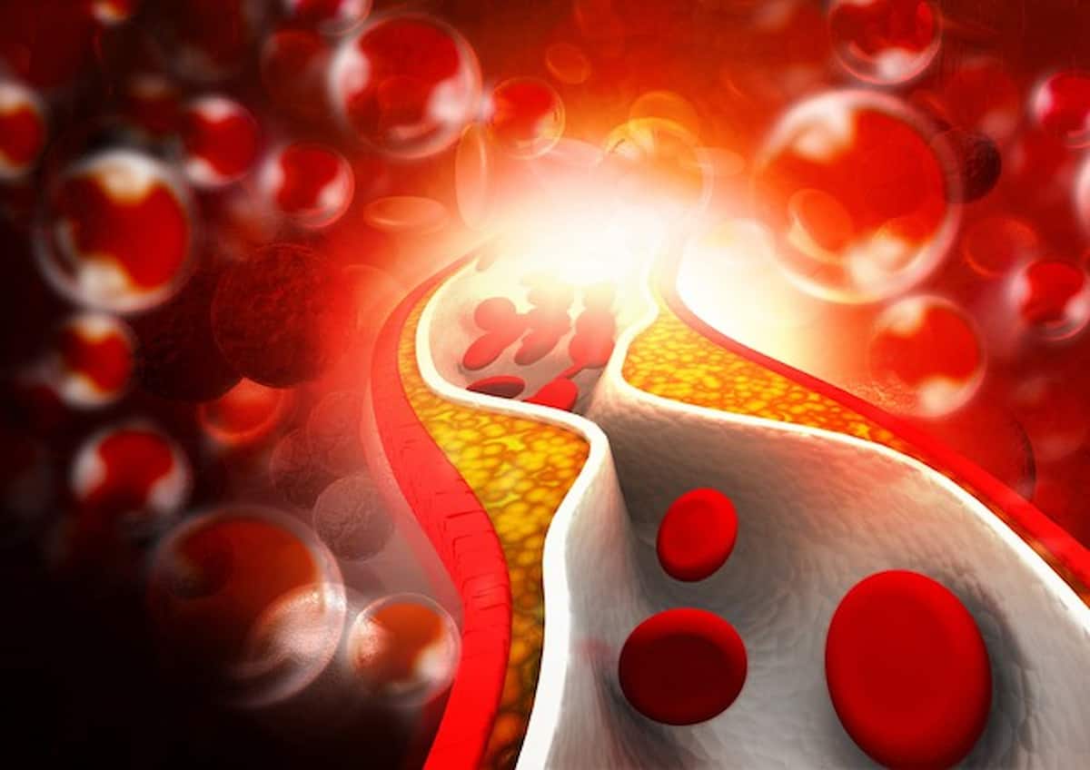 Colesterolo ridotto con un nuovo editing genetico, risultati di un esperimento su 10 malati in America, ora ci sarà uno studio su larga scala