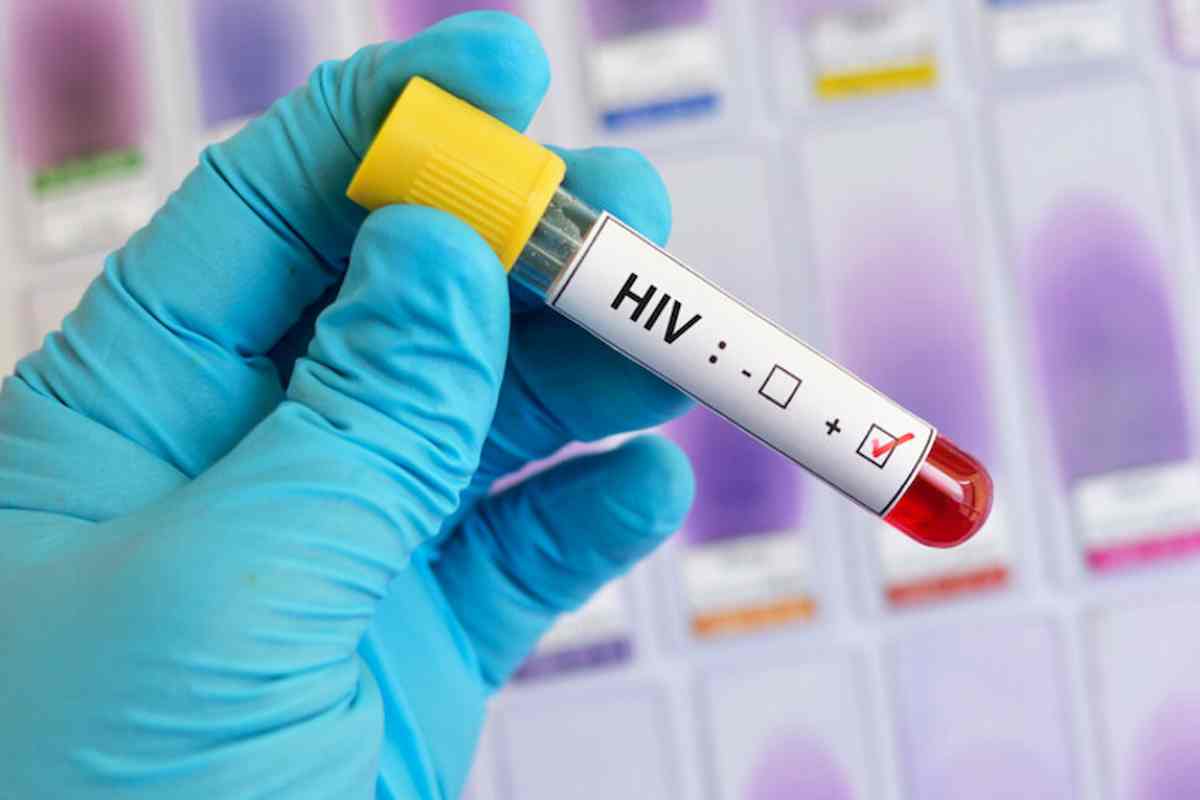 guarisce hiv trapianto midollo