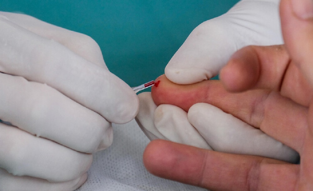 Test del sangue